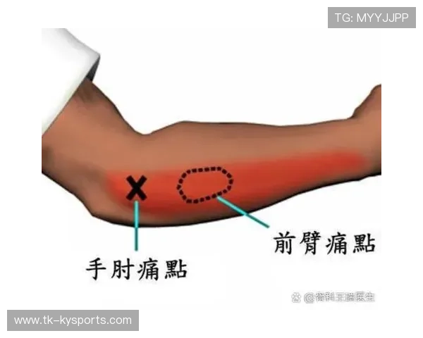 专家提醒：青少年不宜长期使用过重球拍，以防止手腕损伤